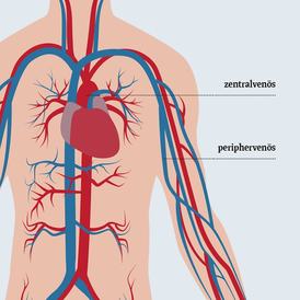 Vascular Access